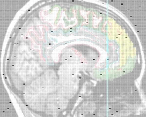 Anatomy of the Brain photo mosaic